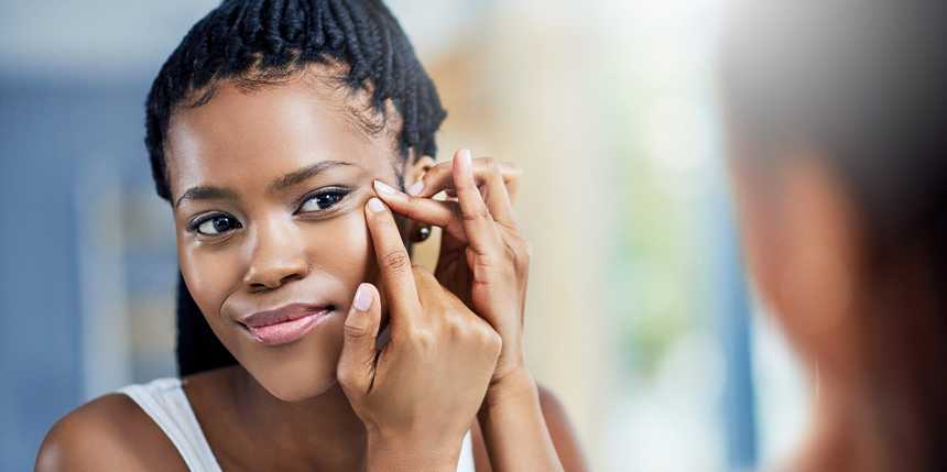  How you can Get Rid of Your Cystic Zits Like a Dermatologist